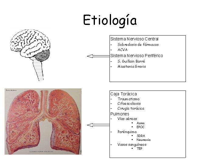 Etiología Sistema Nervioso Central – – Sobredosis de fármacos ACVA Sistema Nervioso Periférico – Etiología Sistema Nervioso Central – – Sobredosis de fármacos ACVA Sistema Nervioso Periférico –