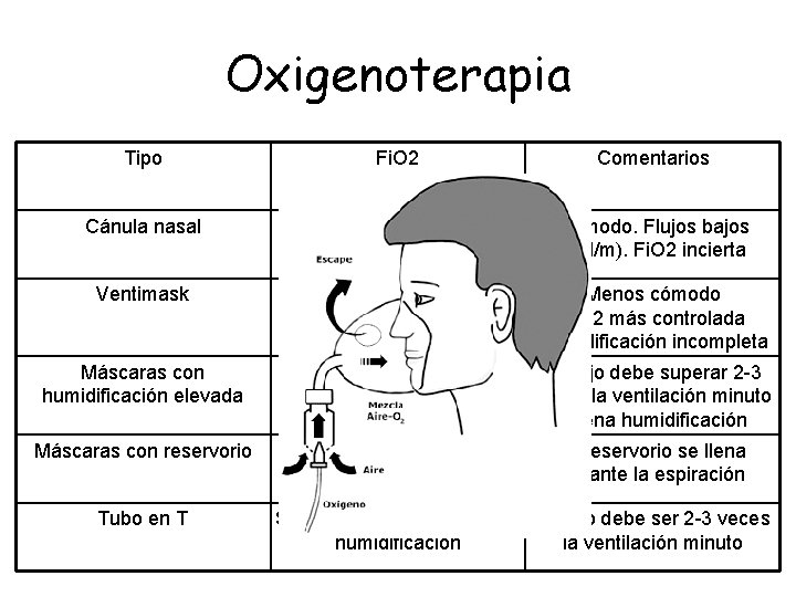 Oxigenoterapia Tipo Fi. O 2 Comentarios Cánula nasal 1 l/m añade 2 -3% de Oxigenoterapia Tipo Fi. O 2 Comentarios Cánula nasal 1 l/m añade 2 -3% de