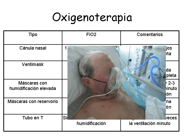 Oxigenoterapia Tipo Fi. O 2 Comentarios Cánula nasal 1 l/m añade 2 -3% de Oxigenoterapia Tipo Fi. O 2 Comentarios Cánula nasal 1 l/m añade 2 -3% de