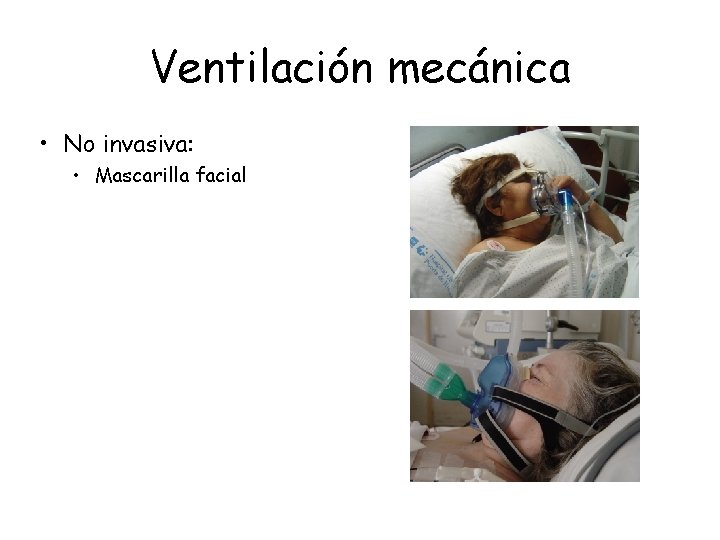 Ventilación mecánica • No invasiva: • Mascarilla facial Ventilación mecánica • No invasiva: • Mascarilla facial