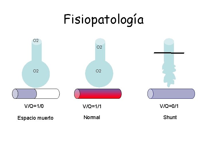 Fisiopatología O 2 O 2 V/Q=1/0 V/Q=1/1 V/Q=0/1 Espacio muerto Normal Shunt Fisiopatología O 2 O 2 V/Q=1/0 V/Q=1/1 V/Q=0/1 Espacio muerto Normal Shunt