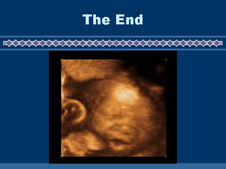 The End The End
