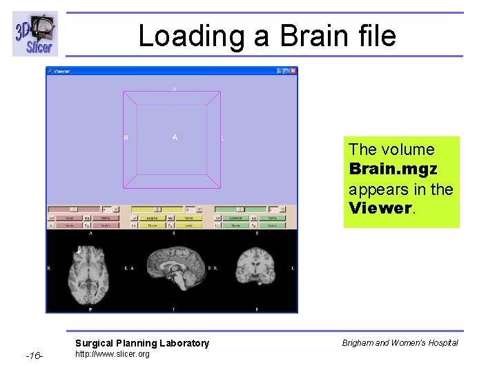 Loading a Brain file The volume Brain. mgz appears in the Viewer. Surgical Planning