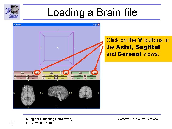 Loading a Brain file Click on the V buttons in the Axial, Sagittal and