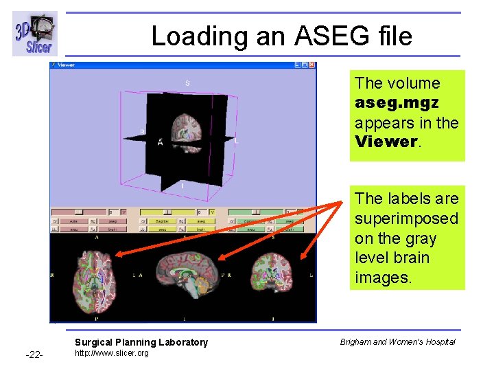 Loading an ASEG file The volume aseg. mgz appears in the Viewer. The labels