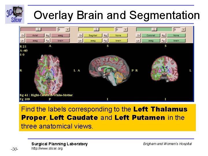 Overlay Brain and Segmentation Find the labels corresponding to the Left Thalamus Proper, Left