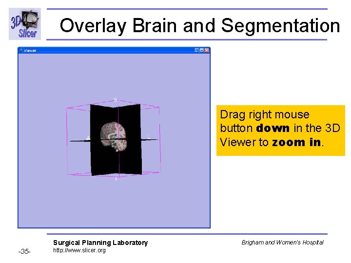 Overlay Brain and Segmentation Drag right mouse button down in the 3 D Viewer