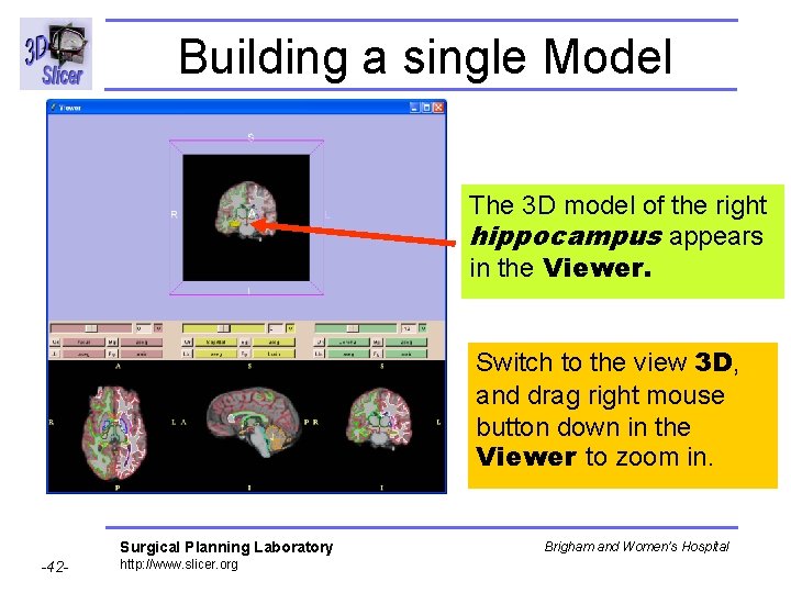 Building a single Model The 3 D model of the right hippocampus appears in