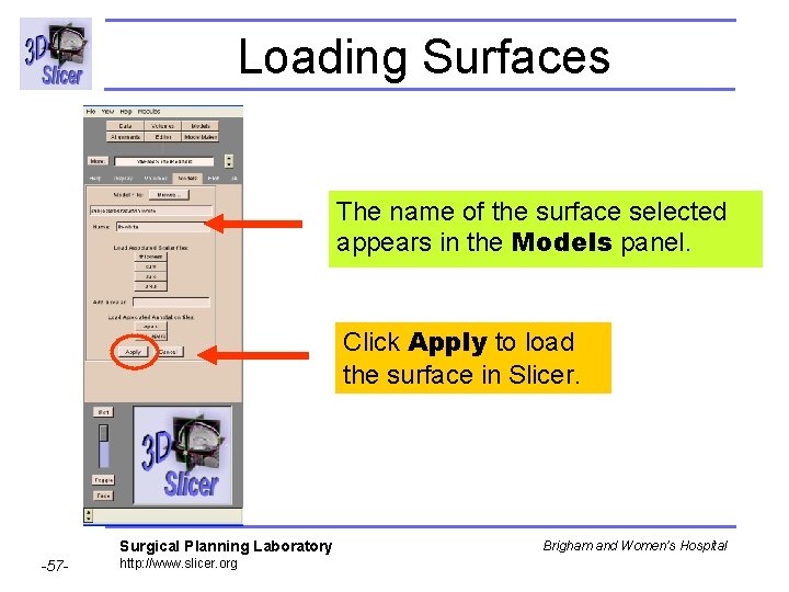 Loading Surfaces The name of the surface selected appears in the Models panel. Click
