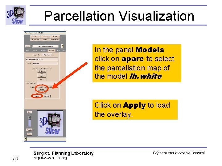 Parcellation Visualization In the panel Models click on aparc to select the parcellation map