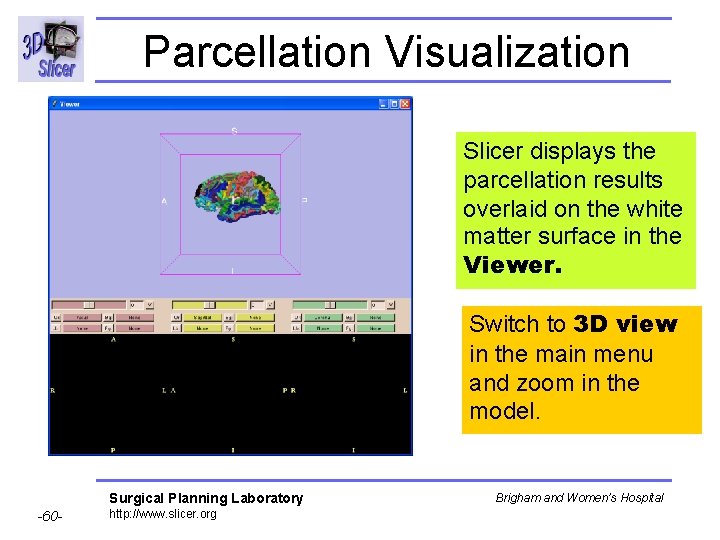Parcellation Visualization Slicer displays the parcellation results overlaid on the white matter surface in