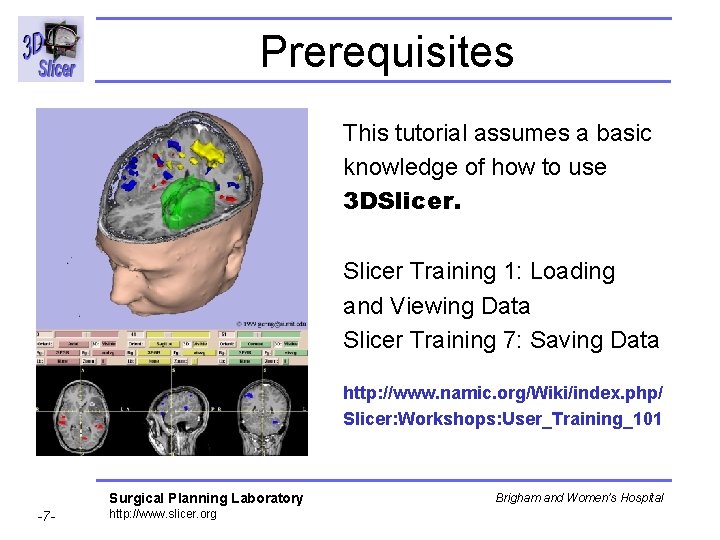 Prerequisites This tutorial assumes a basic knowledge of how to use 3 DSlicer Training