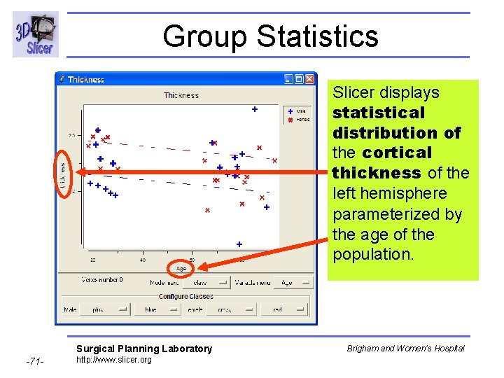 Group Statistics Slicer displays statistical distribution of the cortical thickness of the left hemisphere