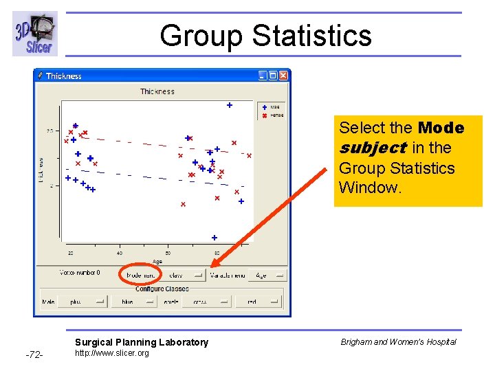 Group Statistics Select the Mode subject in the Group Statistics Window. Surgical Planning Laboratory