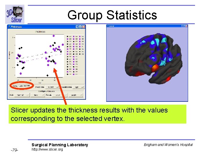 Group Statistics Slicer updates the thickness results with the values corresponding to the selected