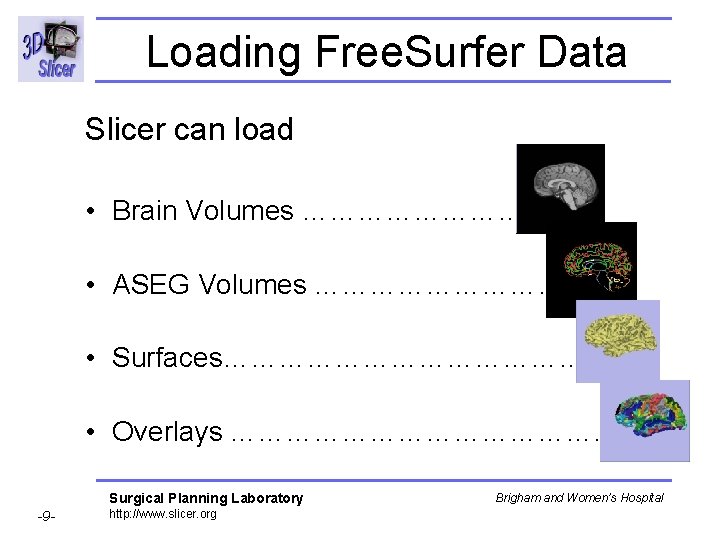 Loading Free. Surfer Data Slicer can load • Brain Volumes …………. • ASEG Volumes