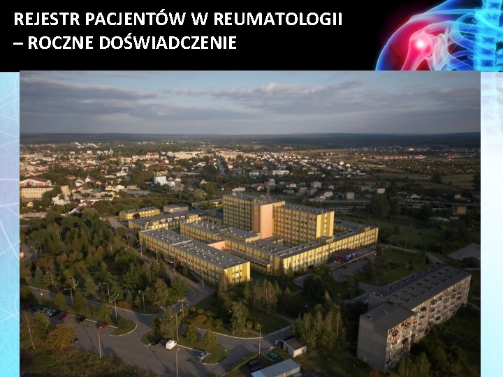 REJESTR PACJENTÓW W REUMATOLOGII – ROCZNE DOŚWIADCZENIE 