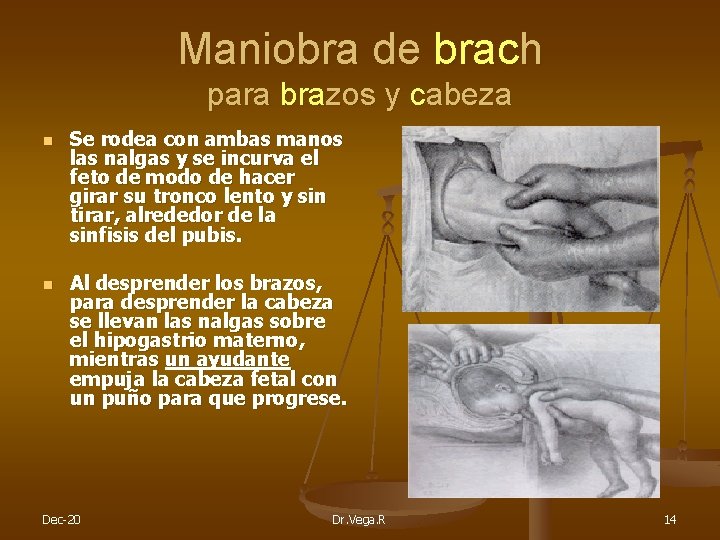 Maniobra de brach para brazos y cabeza n n Se rodea con ambas manos