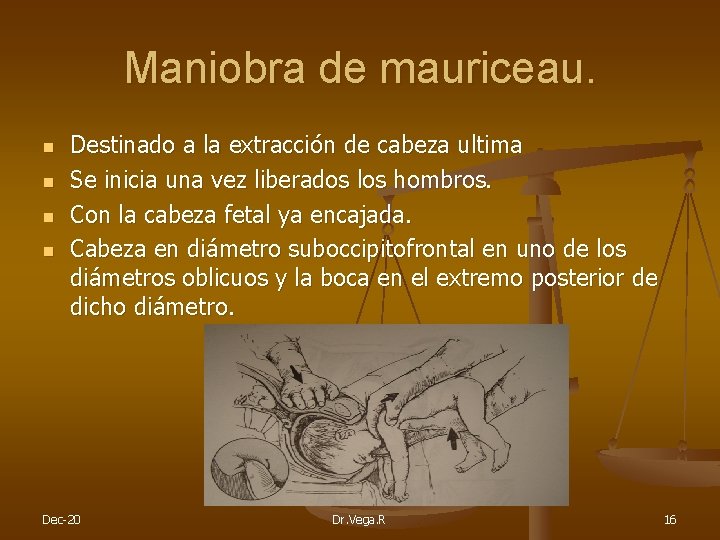 Maniobra de mauriceau. n n Destinado a la extracción de cabeza ultima Se inicia