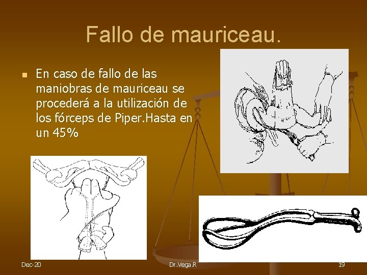 Fallo de mauriceau. n En caso de fallo de las maniobras de mauriceau se