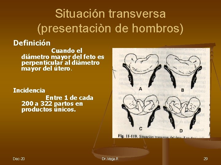 Situación transversa (presentaciòn de hombros) Definición Cuando el diámetro mayor del feto es perpenticular