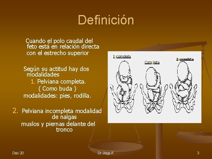 Definición Cuando el polo caudal del feto está en relación directa con el estrecho