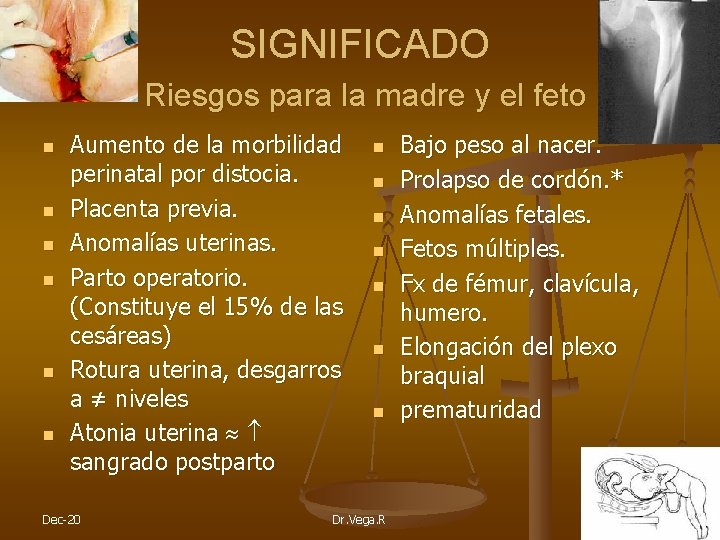 SIGNIFICADO Riesgos para la madre y el feto n n n Aumento de la