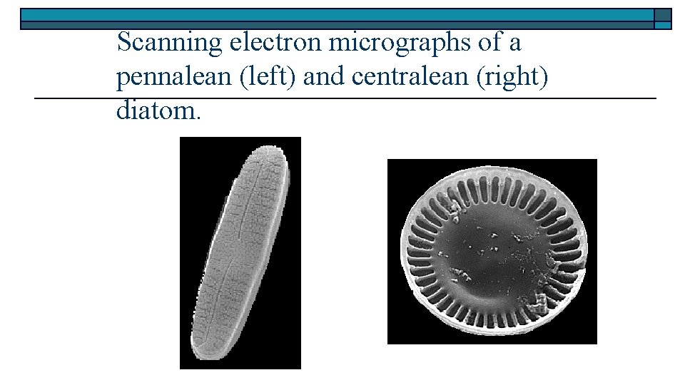 Scanning electron micrographs of a pennalean (left) and centralean (right) diatom. 