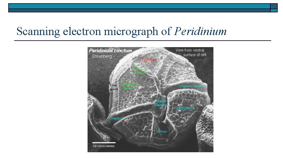 Scanning electron micrograph of Peridinium 
