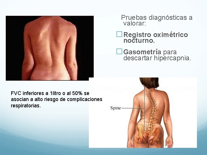 Pruebas diagnósticas a valorar: �Registro oximétrico nocturno. �Gasometría para descartar hipercapnia. FVC inferiores a