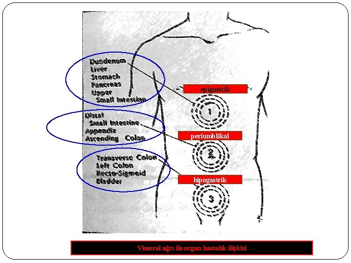 epigastrik periumblikal hipogastrik Visseral ağrı ile organ hastalık ilişkisi 