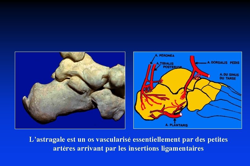 L’astragale est un os vascularisé essentiellement par des petites artères arrivant par les insertions
