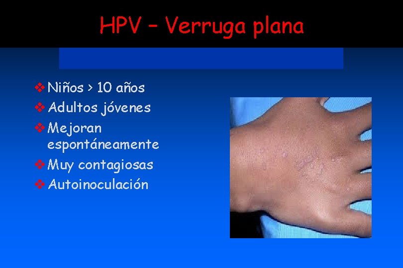 HPV – Verruga plana v Niños > 10 años v Adultos jóvenes v Mejoran
