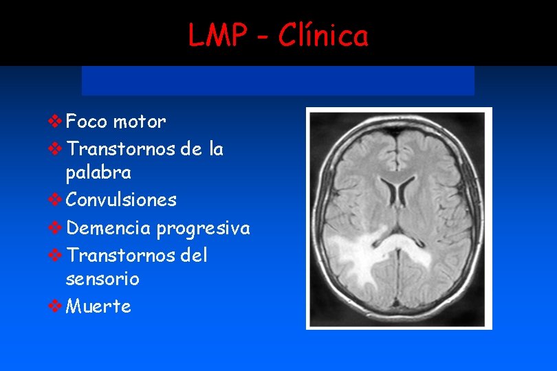 LMP - Clínica v Foco motor v Transtornos de la palabra v Convulsiones v