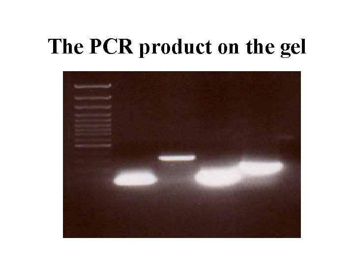 The PCR product on the gel 