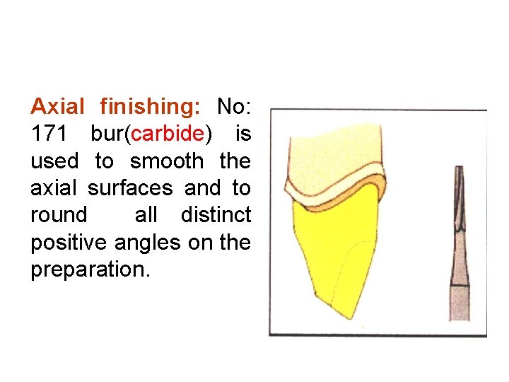 Axial finishing: No: 171 bur(carbide) is used to smooth the axial surfaces and to