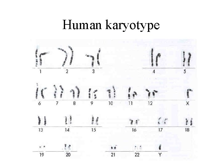 Human karyotype 