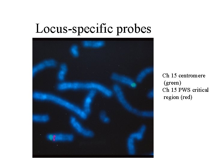 Locus-specific probes Ch 15 centromere (green) Ch 15 PWS critical region (red) 