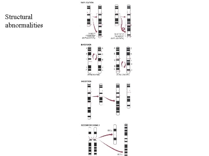 Structural abnormalities 