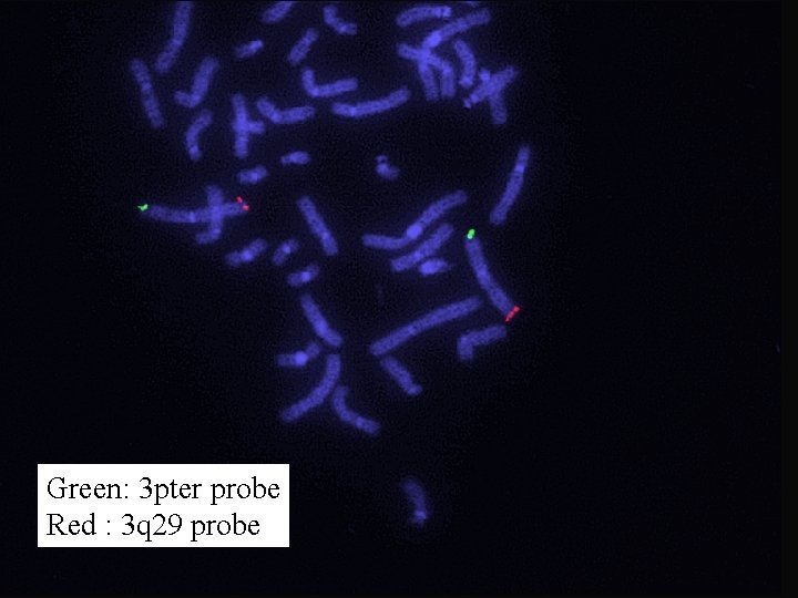 Green: 3 pter probe Red : 3 q 29 probe 