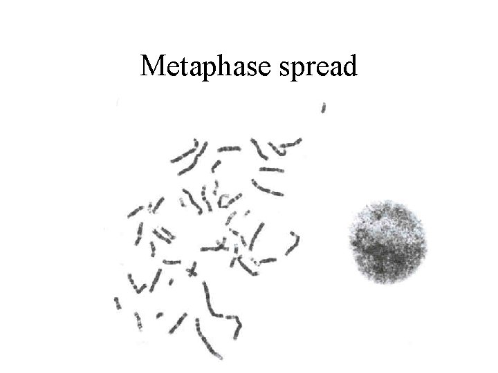 Metaphase spread 