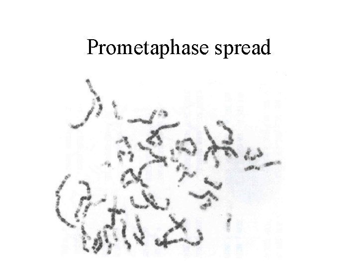 Prometaphase spread 