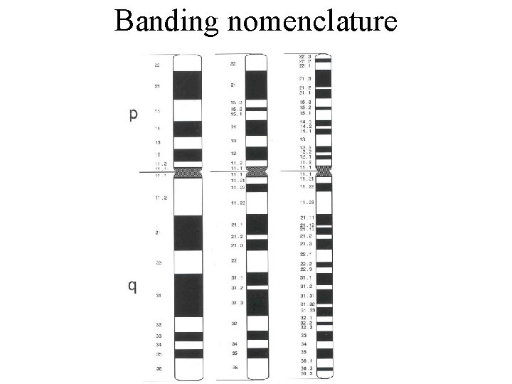 Banding nomenclature 