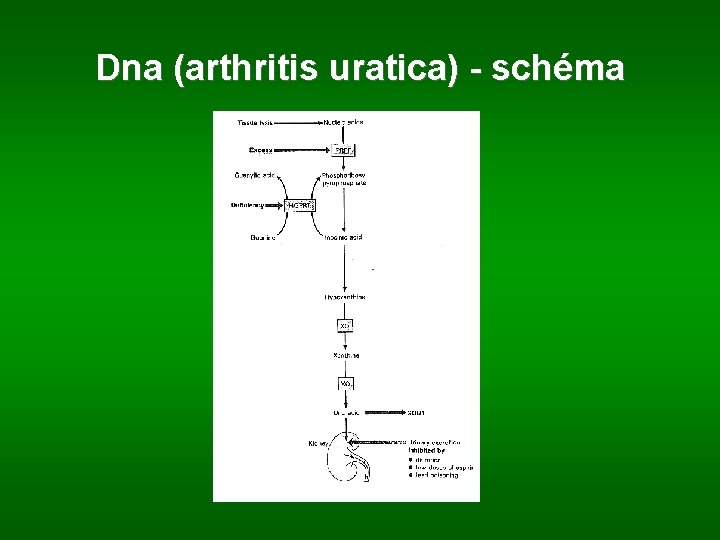 Dna (arthritis uratica) - schéma 