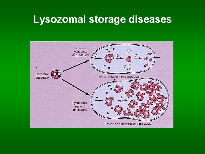 Lysozomal storage diseases 