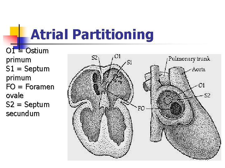Atrial Partitioning O 1 = Ostium primum S 1 = Septum primum FO =
