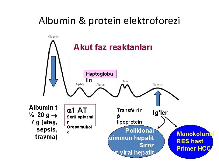 Albumin & protein elektroforezi Akut faz reaktanları Haptoglobu lin Albumin t ½ 20 g