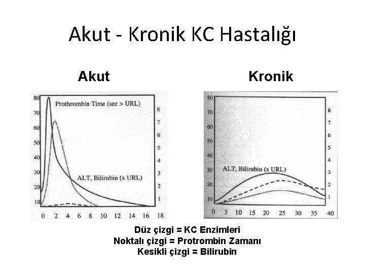 Akut - Kronik KC Hastalığı Akut Kronik Düz çizgi = KC Enzimleri Noktalı çizgi
