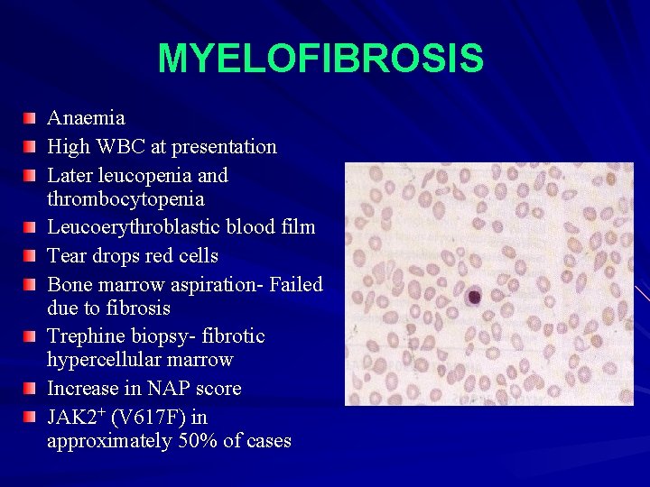 MYELOFIBROSIS Anaemia High WBC at presentation Later leucopenia and thrombocytopenia Leucoerythroblastic blood film Tear