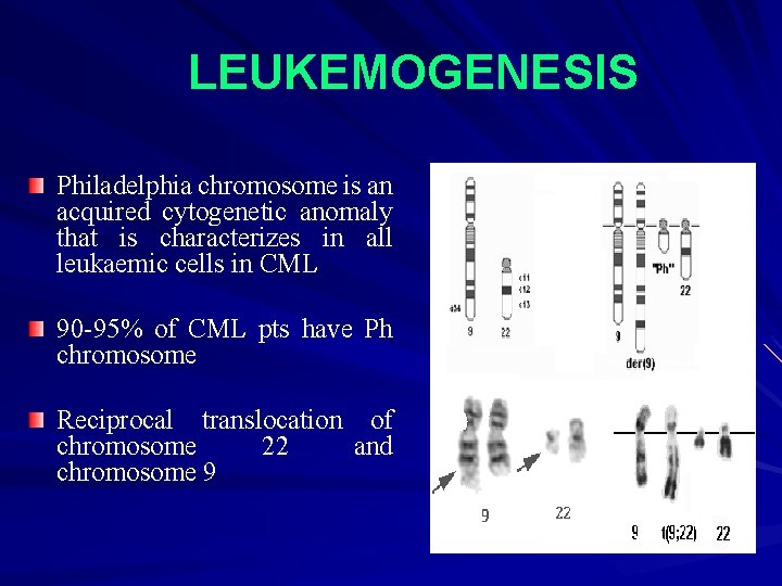 LEUKEMOGENESIS Philadelphia chromosome is an acquired cytogenetic anomaly that is characterizes in all leukaemic